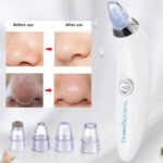 Blackhead Remover Vacuum Acne Cleaner